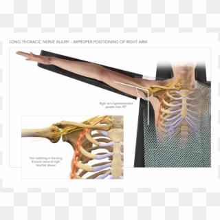 Long Thoracic Nerve Injury - Bone, HD Png Download