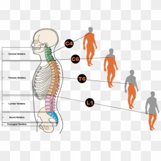 Diagram Showing Different Types Of Spinal Cord Injuries - Illustration, HD Png Download