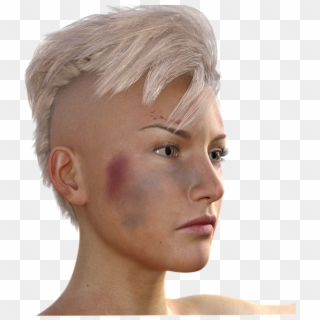Bruised Jaw Female, HD Png Download