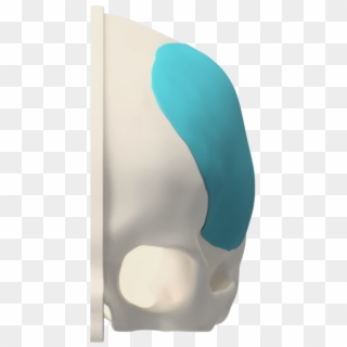 Borda Ossea Front Customize Cranioplastia - Paper, HD Png Download