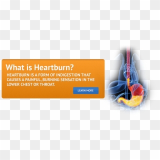 What Is Heartburn - Cancer De Colon, HD Png Download