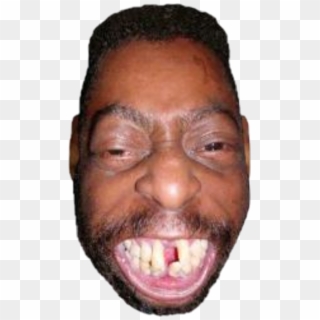 Black People With Fucked Up Teeth , Png Download - Nigga With Fucked Up Teeth, Transparent Png