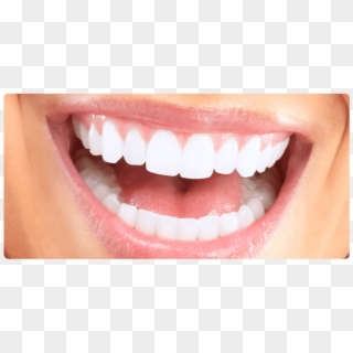 White Teeth - Straight Teeth Smile, HD Png Download