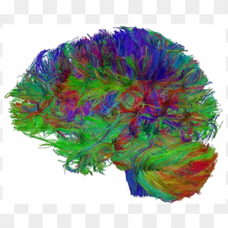 From The Virtual Reconstruction Of White Matter Bundles - Tractographie Irm De Diffusion, HD Png Download