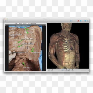 Medical Education Software, HD Png Download