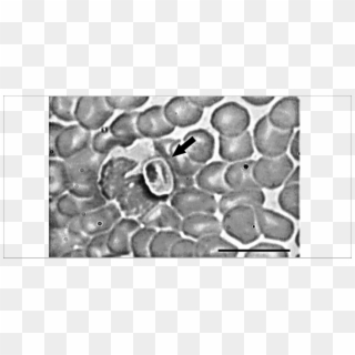 Gametocyte In Peripheral Blood Smear From The Hoary - Monochrome, HD Png Download