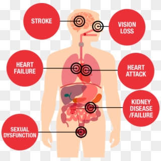 Fail Clipart Health Risk - High Blood Pressure Effects, HD Png Download